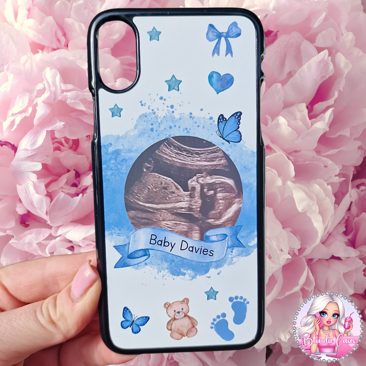 Pregnancy Baby Scan Phone Case