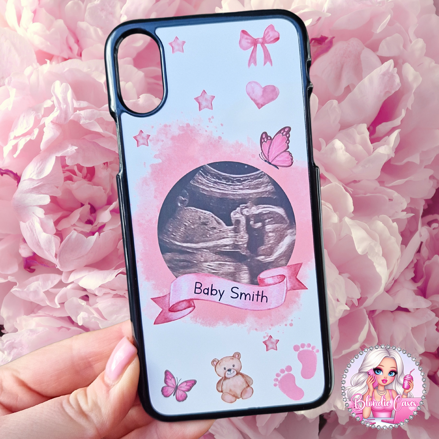 Pregnancy Baby Scan Phone Case
