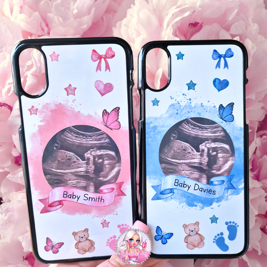 Pregnancy Baby Scan Phone Case